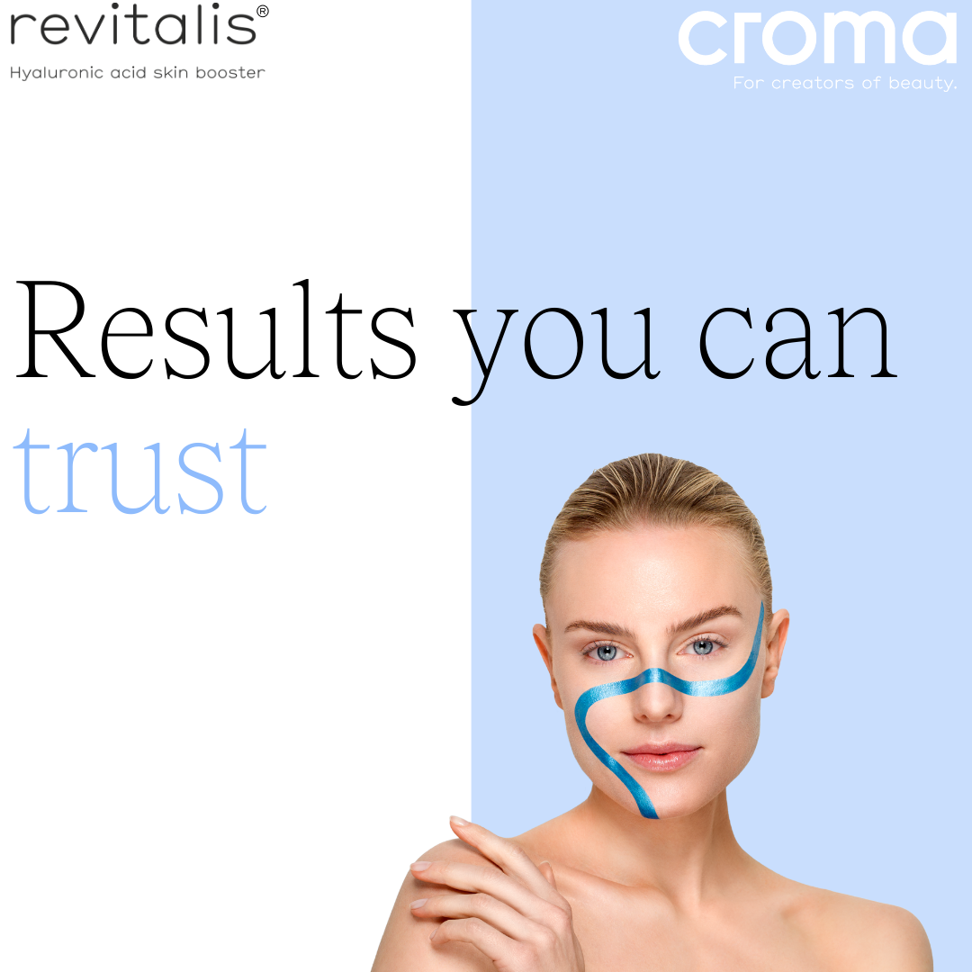 Marketing assets revitalis social 14